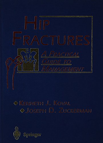 

special-offer/special-offer/hip-fractures-a-practical-guide-to-management--9783540673644