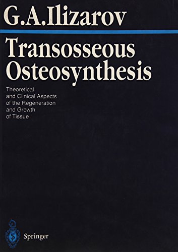 

special-offer/special-offer/transosseous-osteosynthesis--9783540673668