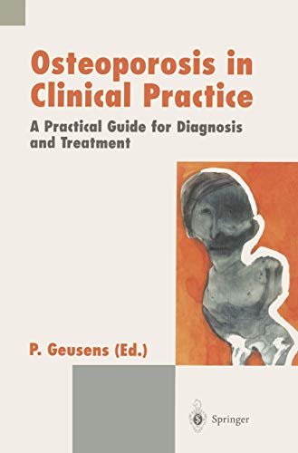 

surgical-sciences/orthopedics/osteoporosis-in-clinical-practice-a-practical-guide-for-diagnosis-and-treatment-9783540762232