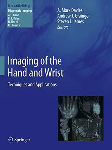 

exclusive-publishers/springer/imaging-of-the-hand-and-wrist-9783642111433