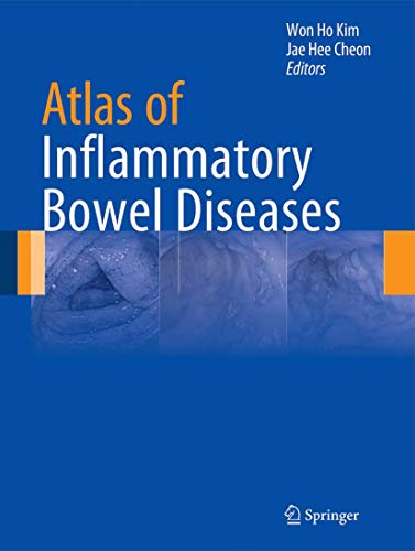 

exclusive-publishers/springer/atlas-of-inflammatory-bowel-diseases--9783642394225