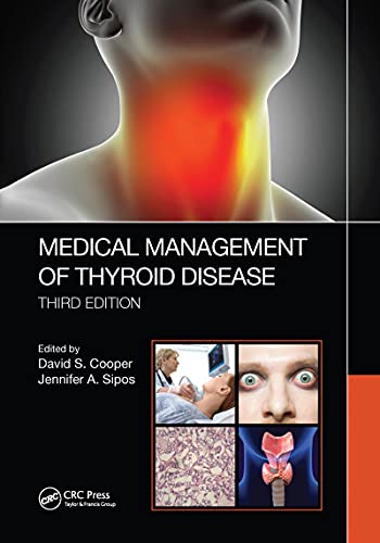 MEDICAL MANAGEMENT OF THYROID DISEASE