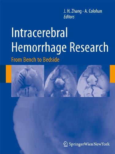 

exclusive-publishers/springer/intracerebral-hemorrhage-research-from-bench-to-bedside-9783709106921