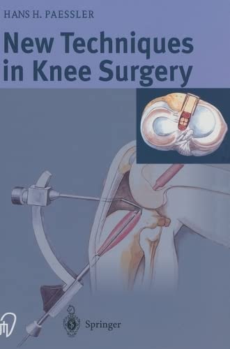 

general-books/general/new-techniques-in-knee-surgery--9783798513877