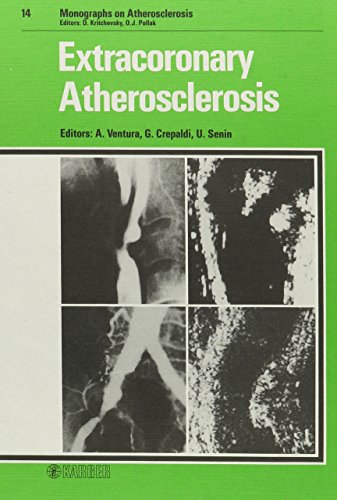 

special-offer/special-offer/extracoronary-atherosclerosis-monographs-on-atherosclerosis--9783805541626