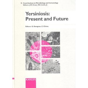 

general-books/general/contributions-to-microbiology-and-immunology-13-yersiniosis-present-and--9783805561389