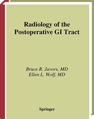 

special-offer/special-offer/radiology-of-the-postoperative-gi-tract--9780387952000