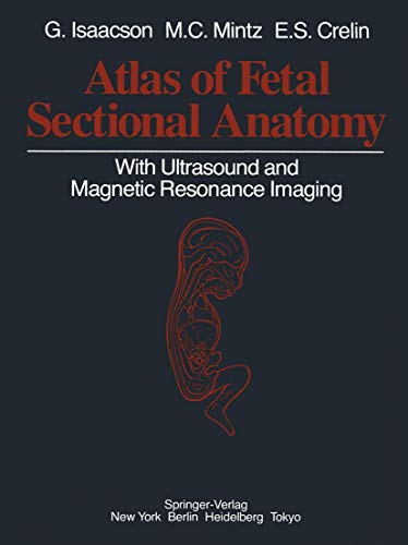 

special-offer/special-offer/atlas-of-fetal-sectional-anatomy-with-ultrasound-and-magnetic-resonance-imaging--9780387962481