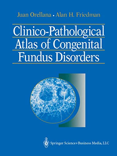 

special-offer/special-offer/clinico-pathological-atlas-of-congential-fundus-disorders-dm-296-00-euro-151-34--9780387979366