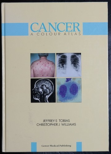 

special-offer/special-offer/cancer-a-colour-atlas--9780397445851