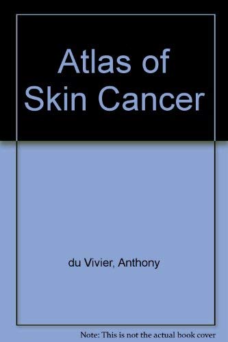 

special-offer/special-offer/atlas-of-skin-cancer--9780397448364