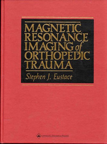 

special-offer/special-offer/magnetic-resonance-imaging-of-orthopedic-trauma--9780412152115