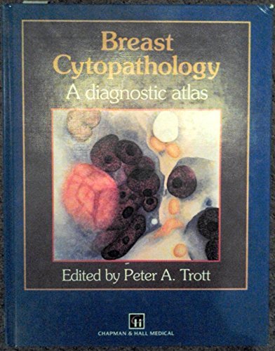 

special-offer/special-offer/breast-cytopathology-a-diagnostic-atlas--9780412282805