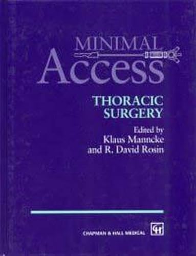

special-offer/special-offer/minimal-access-thoracic-surgery--9780412816000