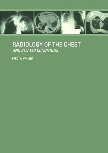 

special-offer/special-offer/radiology-of-the-chest-and-related-conditions-with-cd-rom--9780415281416