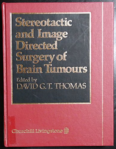 

special-offer/special-offer/stereotactic-and-image-directed-surgery-of-brain-tumours--9780443044458