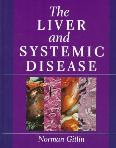 

special-offer/special-offer/the-liver-and-systemic-disease--9780443055461