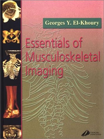 

special-offer/special-offer/essentials-in-musculoskeletal-imaging--9780443065750