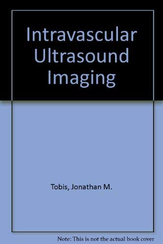 

special-offer/special-offer/intravascular-ultrasound-imaging--9780443088094