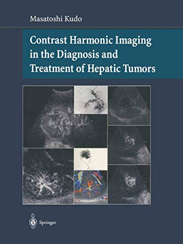 

exclusive-publishers/springer/contrast-harmonic-imaging-in-the-diagnosis-and-treatment-of-hepatic-tumors--9784431000020