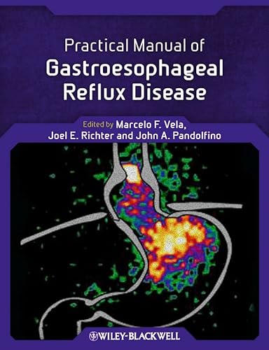 

special-offer/special-offer/practical-manual-of-gastroesophageal-reflux-disease-pb--9780470656266