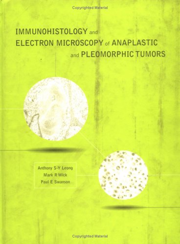 

special-offer/special-offer/immunohistology-and-electron-microscopy-of-anaplastic-and-pleomorphic-tumo--9780521440929