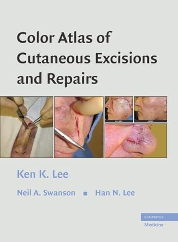 

special-offer/special-offer/color-atlas-of-cutaneous-excisions-and-repairs--9780521860246
