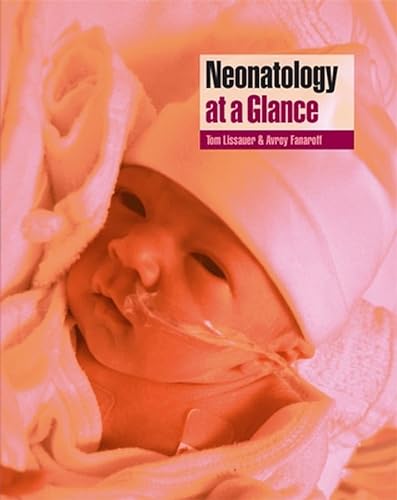 

special-offer/special-offer/neonatology-at-a-glance--9780632055975
