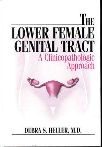 

special-offer/special-offer/the-lower-female-genital-tract-a-clinicopathologic-approach--9780683303407