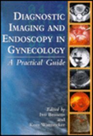 

special-offer/special-offer/diagnostic-imaging-and-endoscopy-in-gynecology--9780702021053