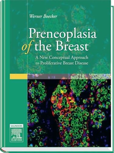 

special-offer/special-offer/preneoplasis-of-the-breast--9780702028922