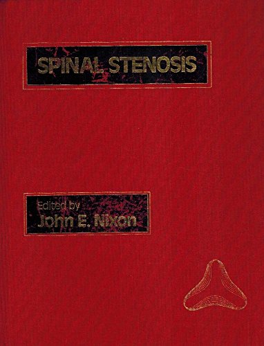 

special-offer/special-offer/spinal-stenosis--9780713145250