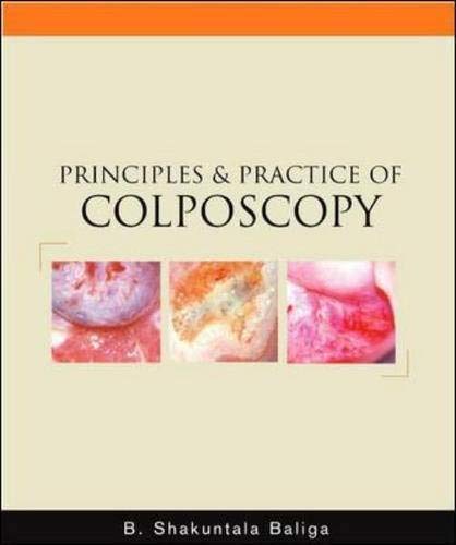

special-offer/special-offer/principles-and-practice-of-colposcopy--9780071446594