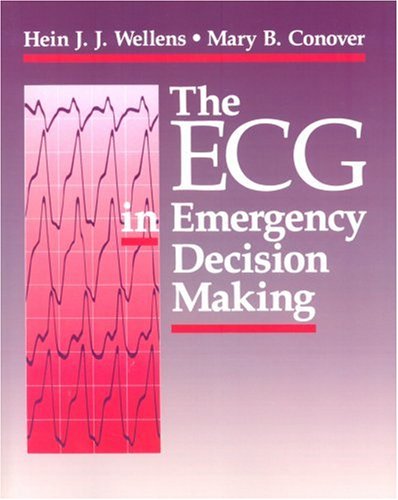 

special-offer/special-offer/the-ecg-in-emergency-decision-making--9780721632148