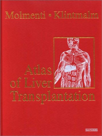 

special-offer/special-offer/atlas-of-liver-transplantation--9780721695518