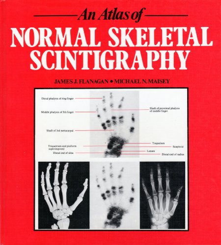 

special-offer/special-offer/an-atlas-of-normal-skeletal-scintigraphy--9780723408291