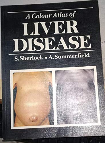 

special-offer/special-offer/a-colour-atlas-of-liver-disease--9780723415589