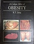 

special-offer/special-offer/a-colour-atlas-of-obesity--9780723415770