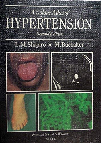

special-offer/special-offer/a-colour-atlas-of-hypertension--9780723416371
