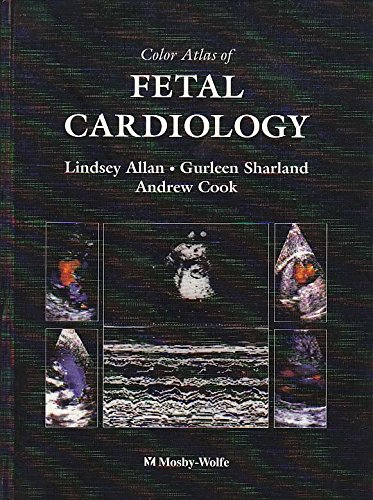 

special-offer/special-offer/color-atlas-of-fetal-cardiology--9780723416982