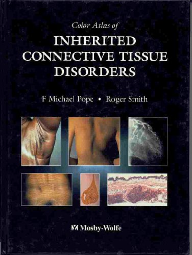 

special-offer/special-offer/color-atlas-of-inherited-connective-tissue-disorders--9780723417965