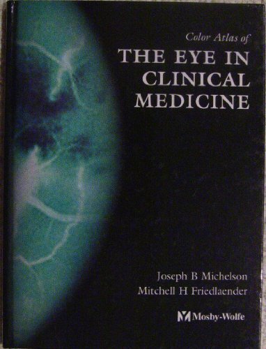 

special-offer/special-offer/color-atlas-of-the-eye-in-clinical-medicine--9780723421474
