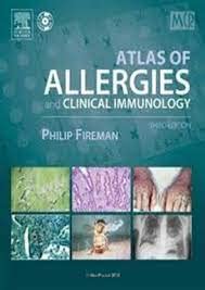 

special-offer/special-offer/atlas-of-allergies-2-ed--9780723421818