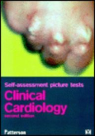

special-offer/special-offer/self-assessment-picture-tests-clinical-cardiology-self-assessment-pictur--9780723425915