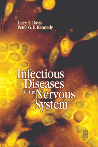 

special-offer/special-offer/infectious-diseases-of-the-nervous-system-1e--9780750642132