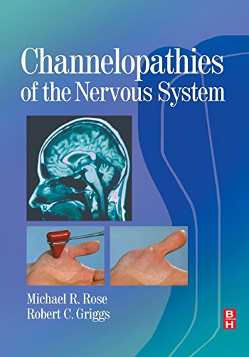 

special-offer/special-offer/channelopathies-of-the-nervous-system-1e--9780750645072