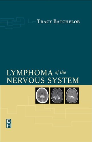 

special-offer/special-offer/lymphoma-of-the-nervous-system-hb--9780750674065