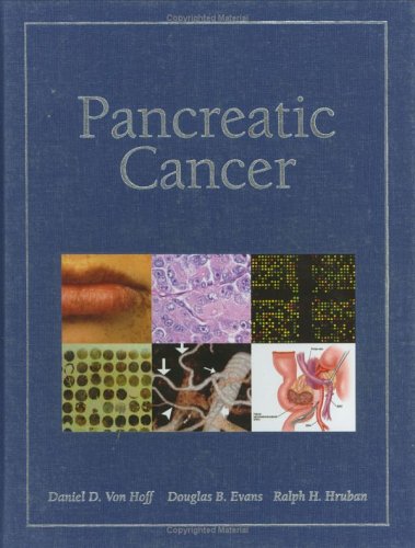 

special-offer/special-offer/pancreatic-cancer-cb--9780763721787