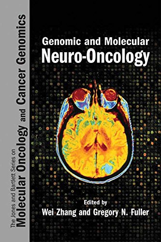 

special-offer/special-offer/genomic-and-molecular-neuro-oncology--9780763722616