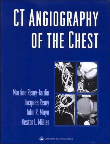 

special-offer/special-offer/ct-angiography-of-the-chest--9780781727310